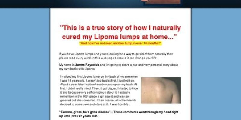 Truth About Lipoma by James Reynolds