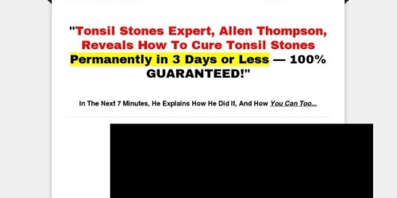 How To Cure Tonsil Stones – How to Cure Tonsil Stones