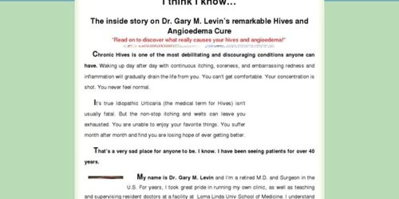Natural Urticaria (Hives) & Angioedema Treatment By Dr. Gary M Levin Hives Urticaria & Angioedema Treatment System | Cure & Relief